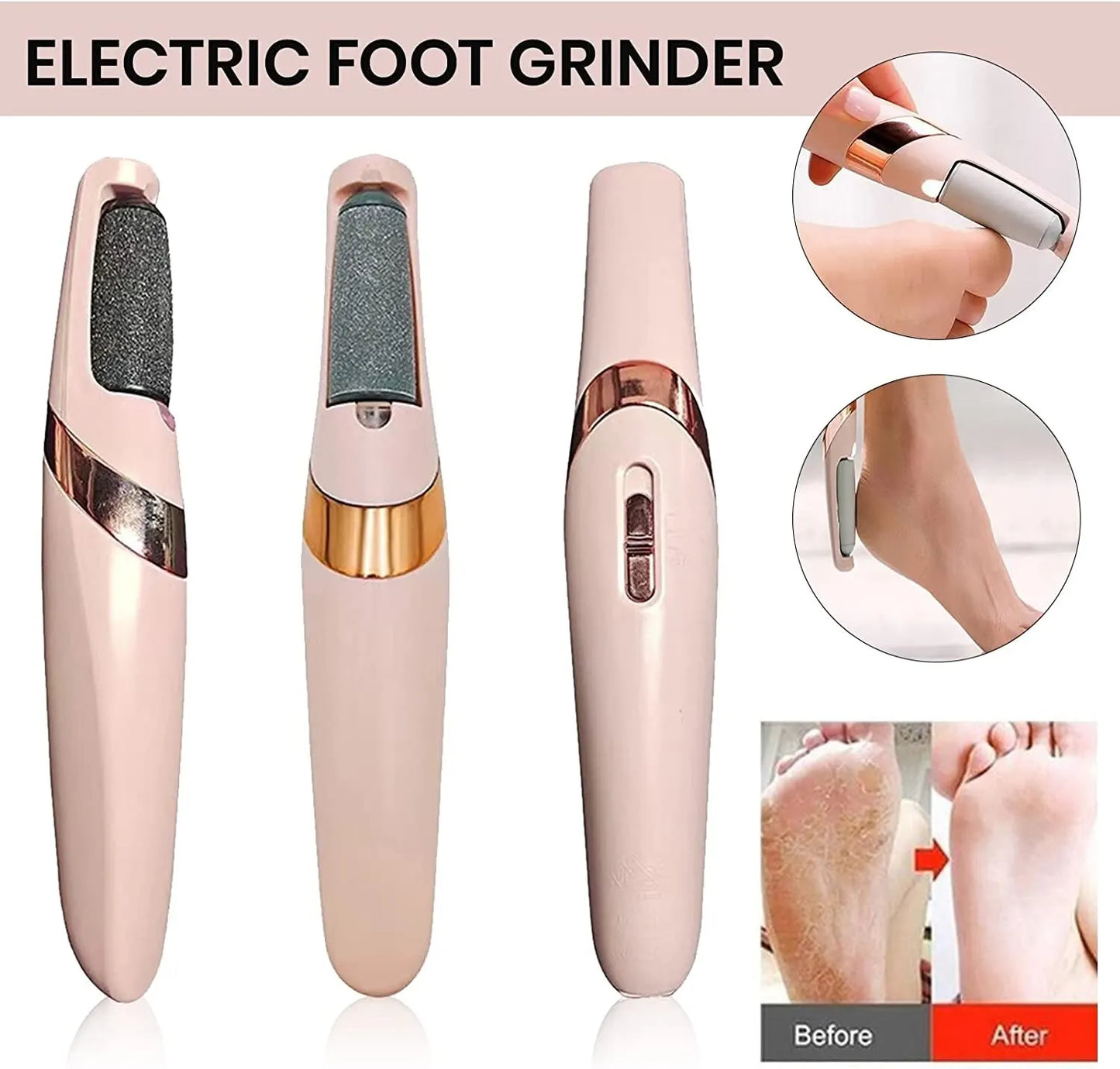 🧼 Electronic Foot Care Tool